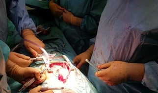 By mogły żyć - na odziale kardiochirurgii GCZD