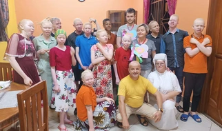 Tanzania. Misja siostry Amelii wśrod dzieci z albinizmem