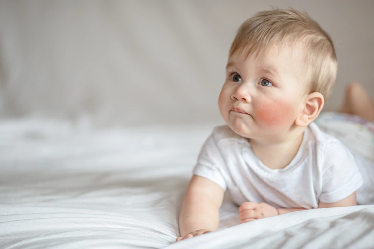 Przeziębione dziecko? Jak pomóc mu szybko dojść do zdrowia?