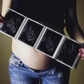 Felek mógł żyć. Prokuratura bada śmierć dziecka, zabitego w 37. tygodniu ciąży 