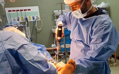 Amputacje ratują rannych przed sepsą i śmiercią,  jednak  dla lekarzy pozostaną traumą  na długie lata. 