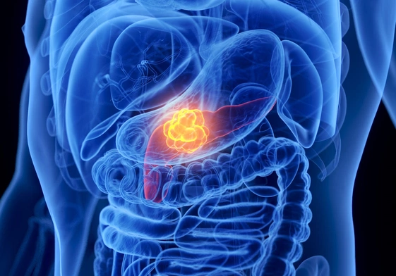 Od lat nie mieliśmy w raku trzustki takiego przełomu - mówi prof. Wyrwicz z Narodowego Instytutu Onkologii