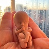 Irlandia: apel o śledztwo ws. 108 dzieci, które przeżyły aborcję
