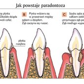 Trzymaj się, zębie!