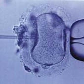 PO wspólnie o in vitro?